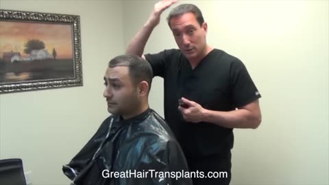 Dr. Brett Bolton Patient Amir – MaxHarvest™ Plus Hair Transplant (Full Length Video)