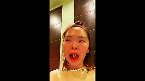 ‎This Girl Grew a Trunk of Teeth?! 😲🦷 #dentalfacts #stories #viralshorts