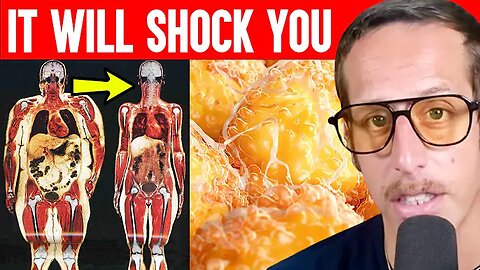 Doctors Can’t Explain What Fasting 16 Hours a Day Does to Your Body 'Ben Azadi'