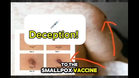 Vaccine Deception! From the LIVE broadcast