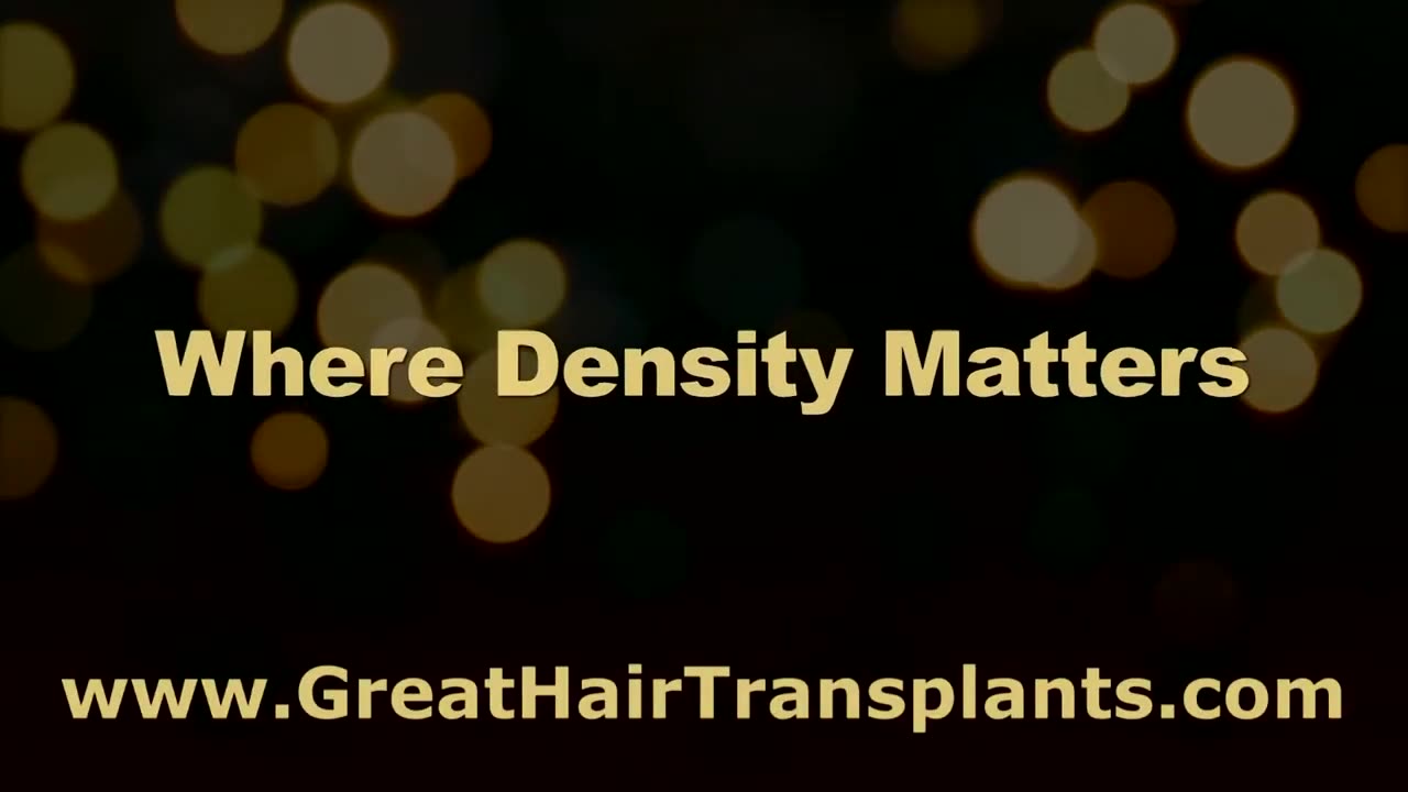 Dr. Brett Bolton How long does a hair transplant last?