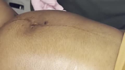 @glammedesthetics Full Stomach Waxing with Sexy Smooth Purple Seduction Hard Wax Tutorial