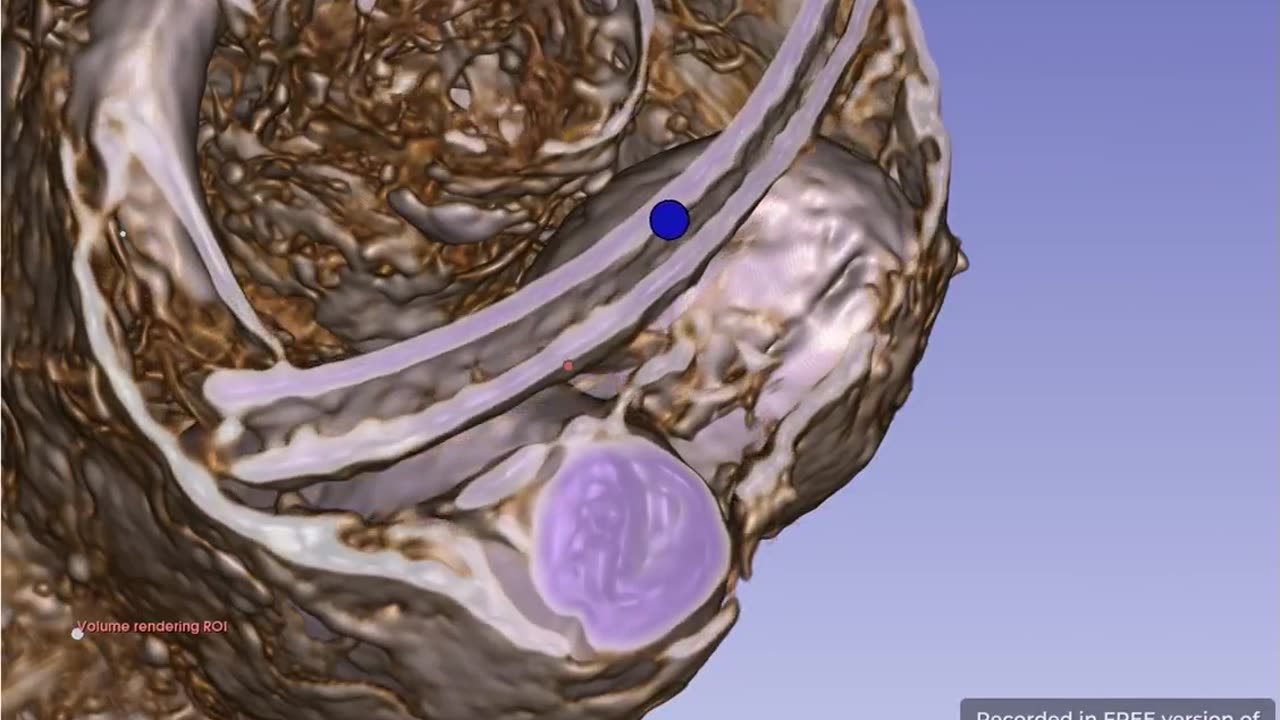 💡🔬 DICOM Files Reveal Capillaries and Veins in Luisa's Eggs! | TheTruthAbove