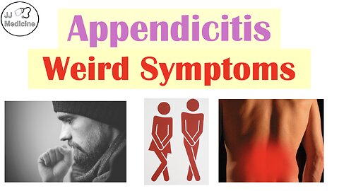 4 Strange Appendicitis Symptoms You'd Never Expect!