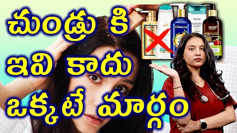 చుండ్రు కి ఇవి కాదు ఒక్కటే మార్గం Best and Healthy Solution for Dandruff Treatment Cure | హోమియోపతి