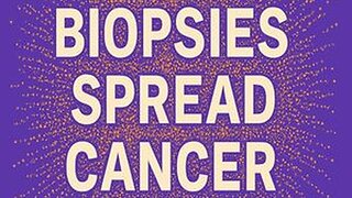 Biopsies spread cancer