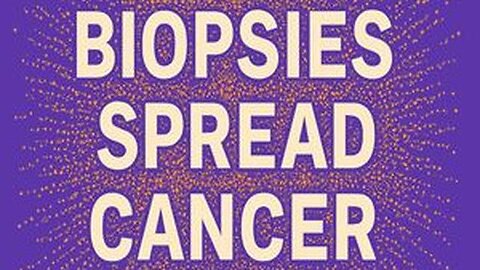 Biopsies spread cancer