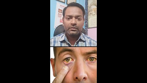 खून को बढ़ाने वाले फल ।