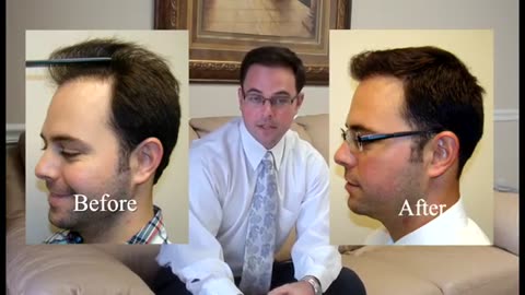 Dr. Brett Bolton Expert Corrective Hair Restoration