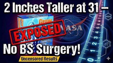 Grow Taller Dynamics by Philip Miller: I Grew 2" at 31 After Plates Closed (2025 Test)