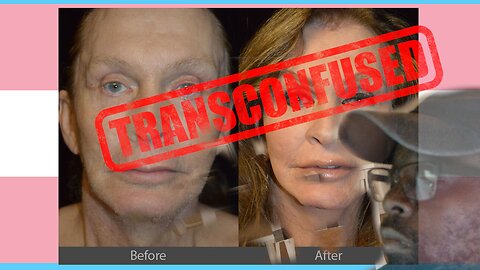 Transgender supporters are Transconfused!