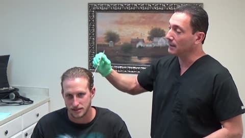 Dr. Brett Bolton: 3-Year Hair Transplant Follow-Up – 24-Year-Old Patient (Part 3)