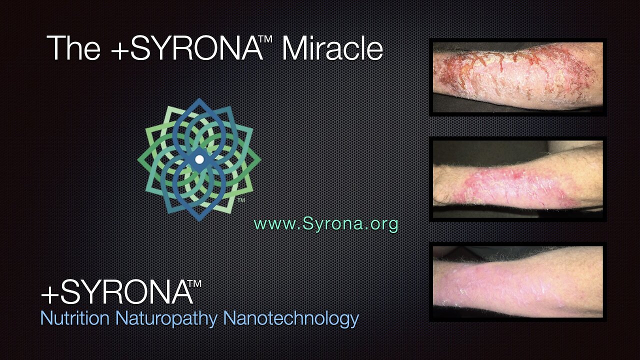 The +SYRONA Miracle