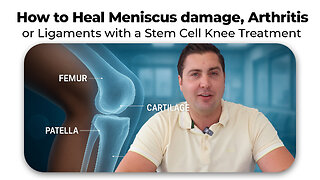 How to Heal Meniscus damage, Arthritis or Ligaments with a Stem Cell Knee Treatment
