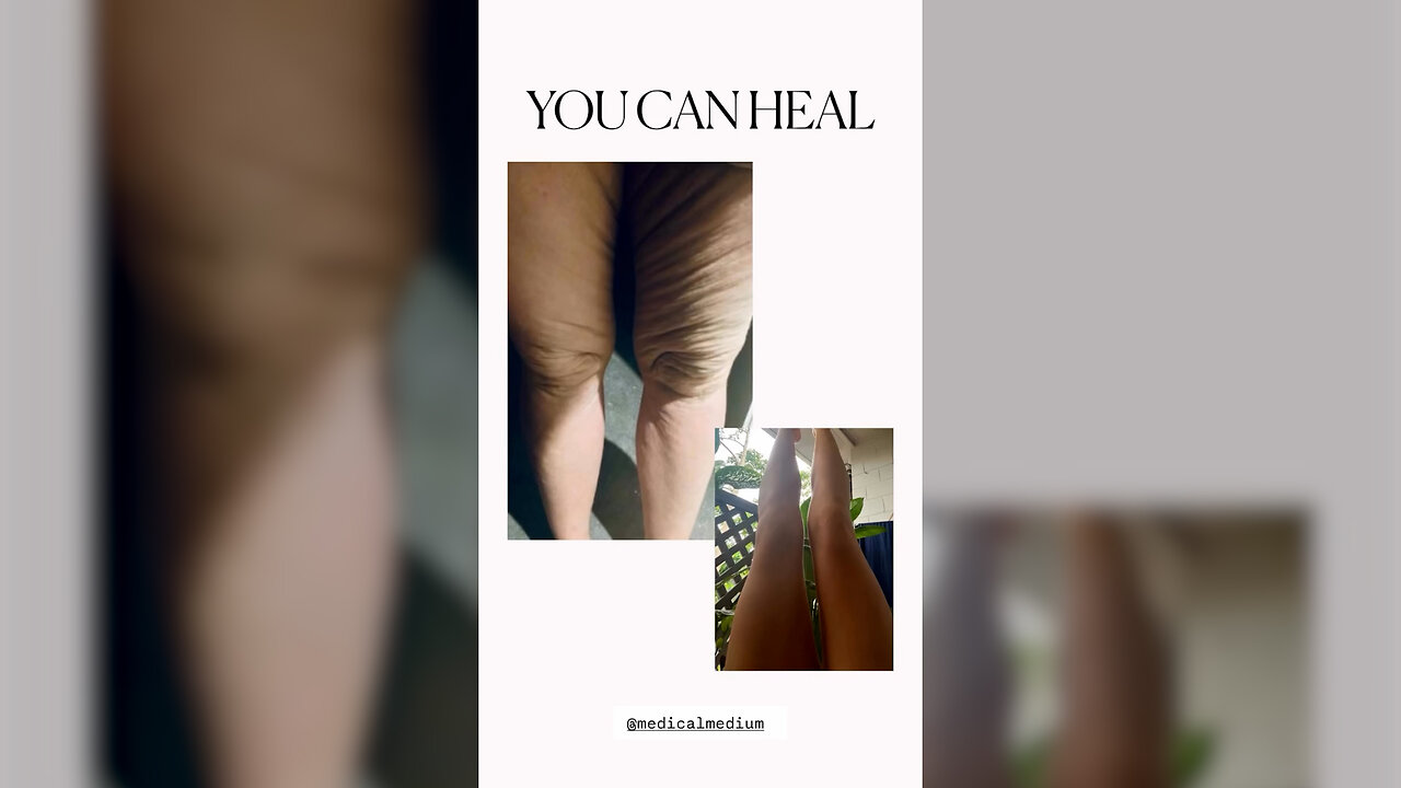 You Can Heal