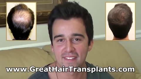 Dr. Brett Bolton Performs Hair Transplant on International Patient