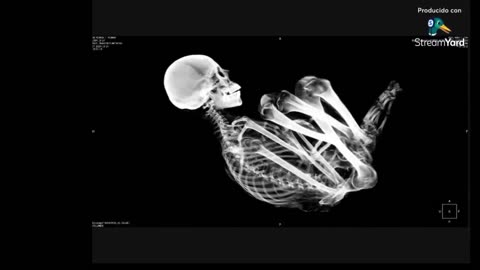 👽🔍 Exclusive Scans of Paloma: Alien or Hoax? | TheTruthAbove
