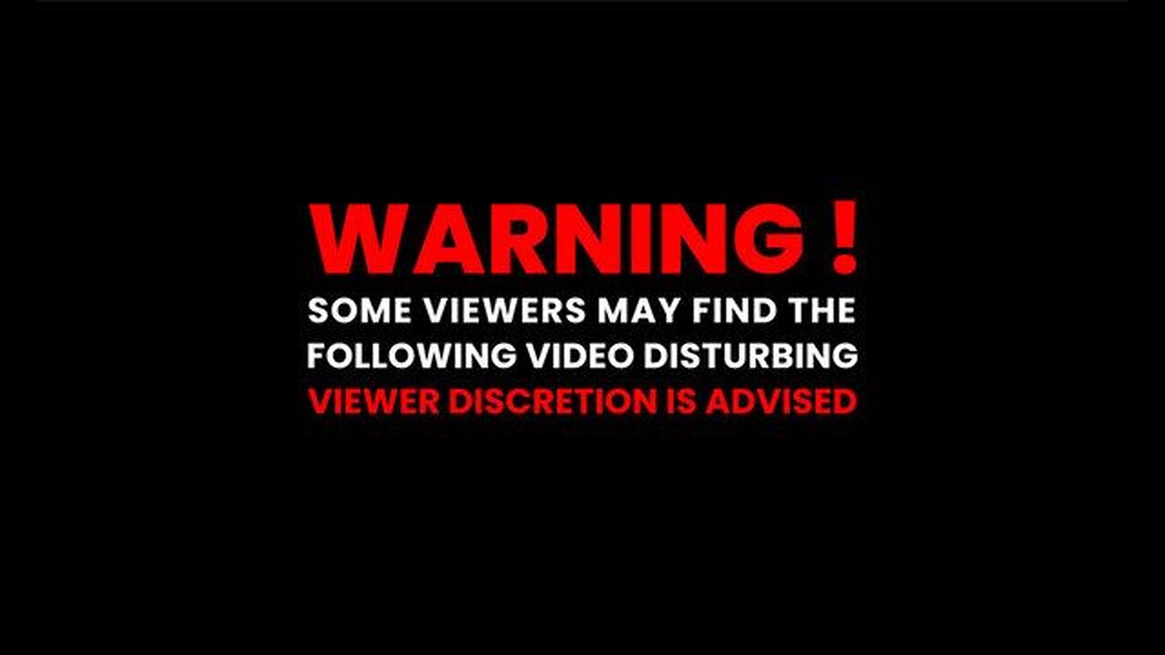 Woman gets her brain ICEd