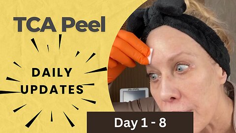 TCA Peel Update Day 1-8 What Did I Use to Speed up my Peel?