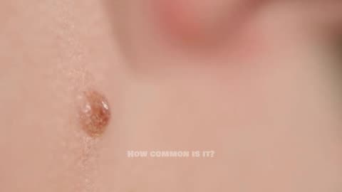 Why Some People Have Three Nipples Explained