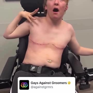 Look what the woke have done! This child with Downs Syndrome has succumbed to this gender ideology