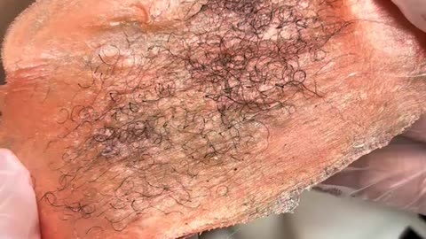 Underarm Waxing with Sexy Smooth Tangerine Tease Hard Wax | @kaylonesthetics | Smooth Results 🍊✨