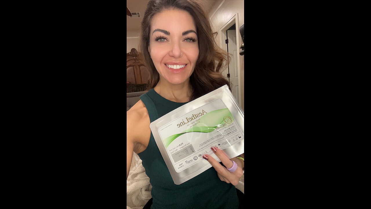 PLLA threads in Nasal Folds