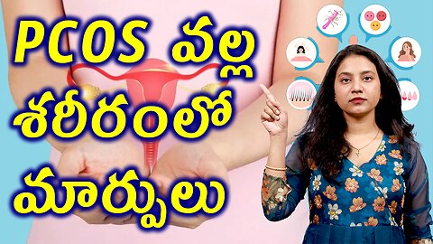 చుండ్రు ప్రభావం ఎలా ఉంటుంది? Changes in the body due to Dandruff Control Treatment Cure | హోమియోపతి