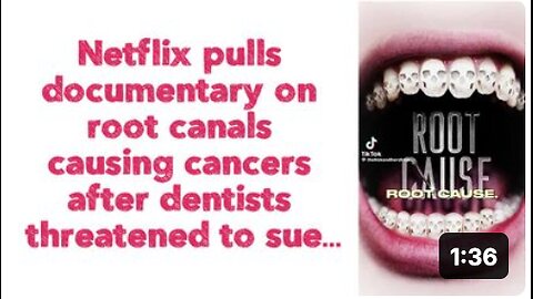 Netflix pulls documentary on 'root canals' causing cancers after dentists threatened to sue….