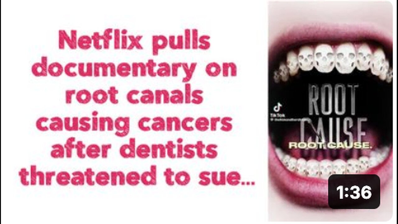 Netflix pulls documentary on 'root canals' causing cancers after dentists threatened to sue….
