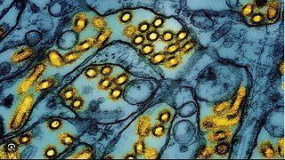 American Dies from Bird Flu Strain, Becoming World’s First Death