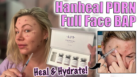 Full Face Bap with Hanheal PDRN! Easy and Fast! AceCosm and code Jessica10 Saves you Money