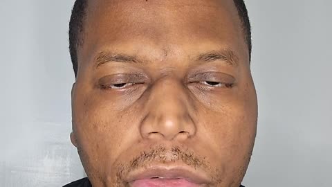 Is sugar fruit healthy?