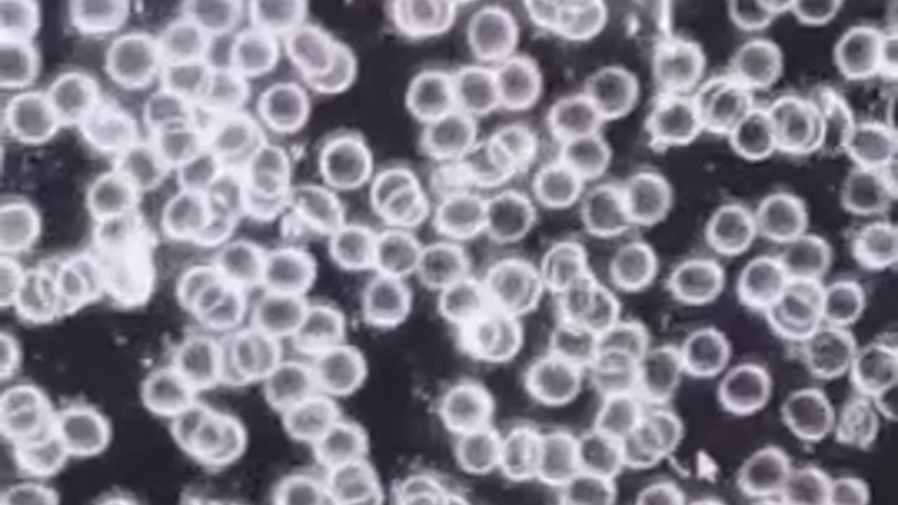Unvaccinated blood before & after detox is both fascinating & scary