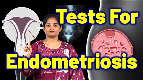 Test For Endometriosis, Female Pelvic Pain | Reproductive Infertility Homeopathy Medicine & Cure