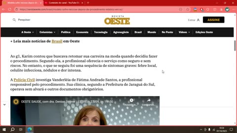 Modelo sofre necrose depois de procedimento estético em SC.mp4
