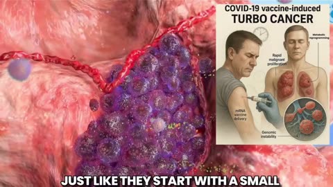 COVID-19 VACCINE-INDUCED TURBO CANCER