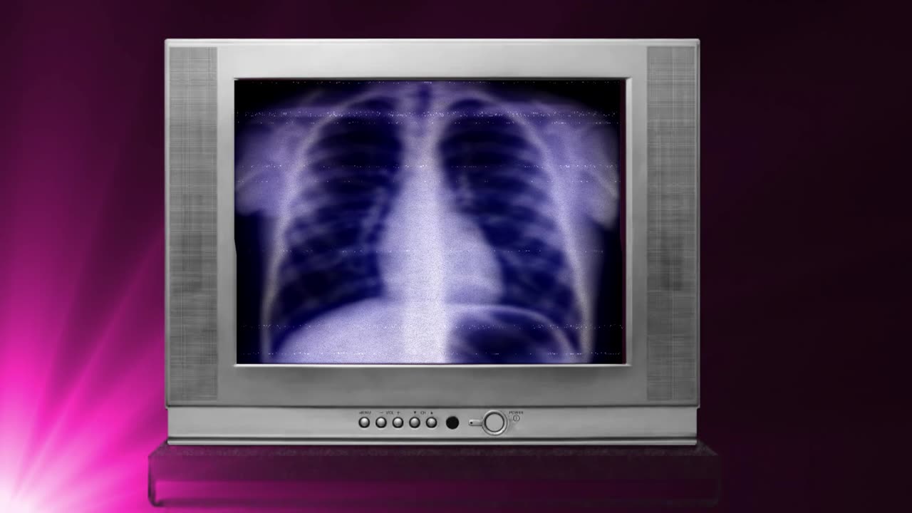 The Rotten Elephant - Sensitive Airway