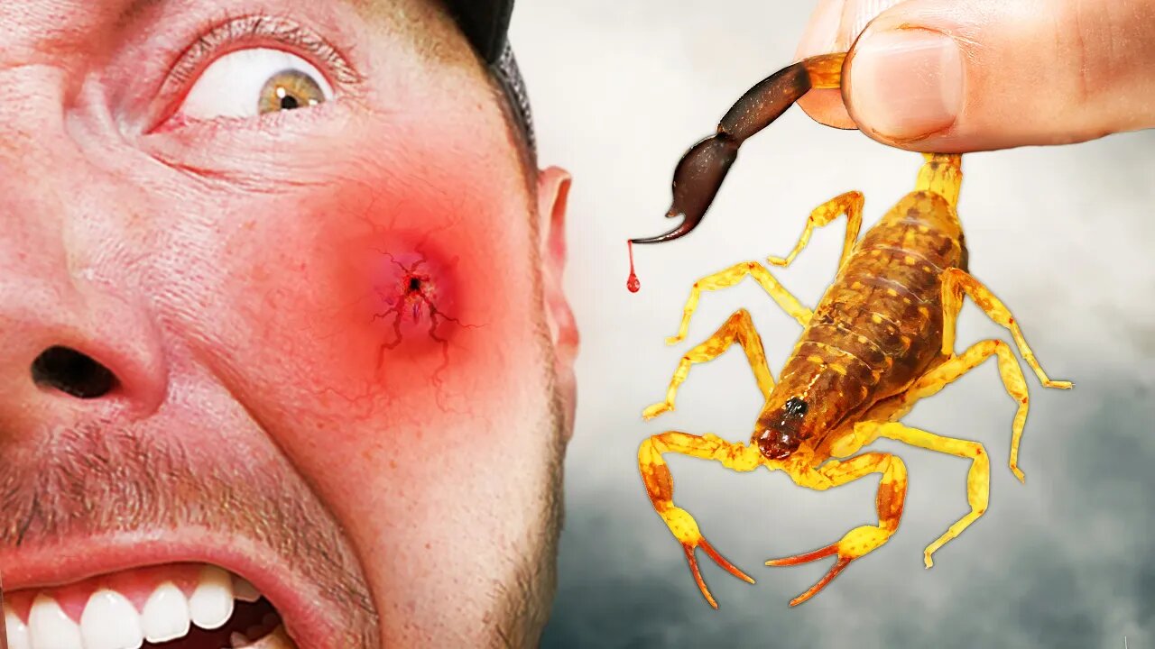 PAINFUL STING From One of Asia's Meanest Scorpions!