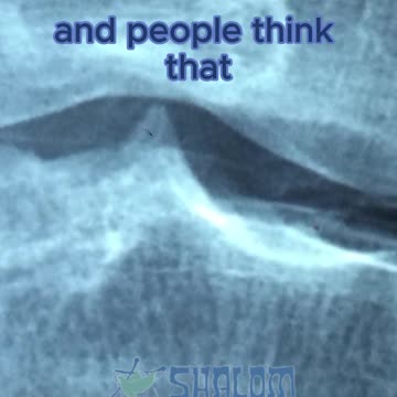 Dr. Linda Carney on Why We Really Lose Calcium #Shorts #DrLindaCarney