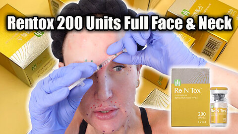 200u Rentox Full Face & Neck - Acecosm.com code STACY10