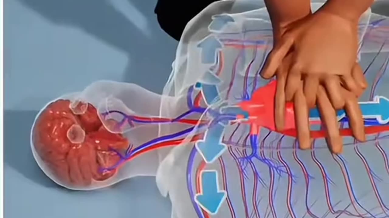 What Happens After a Heart Attack Life-Saving Treatments Explained.