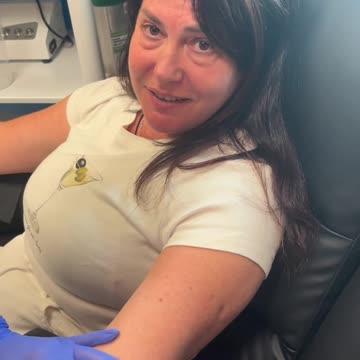 Removing a gel like clot from the victim of the Pfizer Covid shot