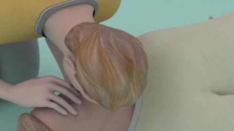 CPR Life Saving Procedure 3D Animation (Cardiopulmonary Resuccitation)
