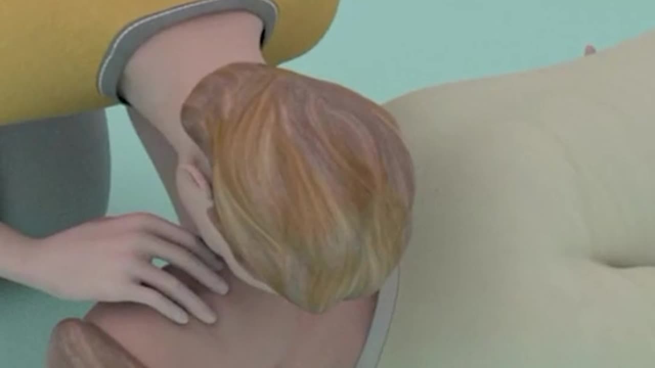 CPR Life Saving Procedure 3D Animation (Cardiopulmonary Resuccitation)