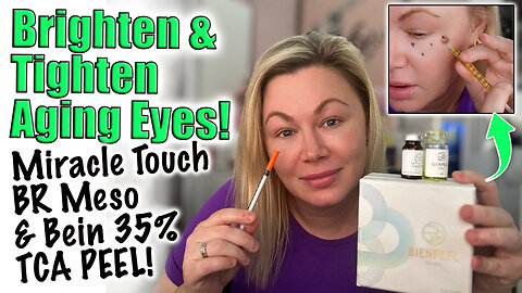 Brighten & Tighten Aging Eyes w/ Bein TCA Peel & Miracle BR, AceCosm! Code Jessica10 Saves