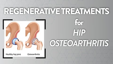 Regenerative treatments for hip osteoarthritis