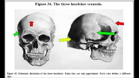 Presentation of Dr. David Mantik on JFK 'Three Headshot Scenario' Followed by Doug Horne Re Same