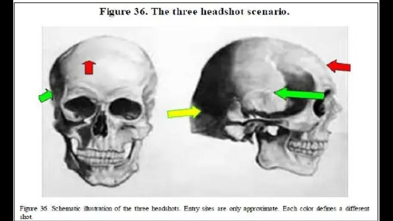 Presentation of Dr. David Mantik on JFK 'Three Headshot Scenario' Followed by Doug Horne Re Same