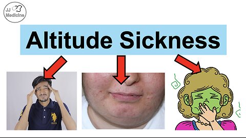 Altitude Sickness (Acute Mountain Sickness) High Altitude Dangers, Symptoms, Diagnosis, Treatment